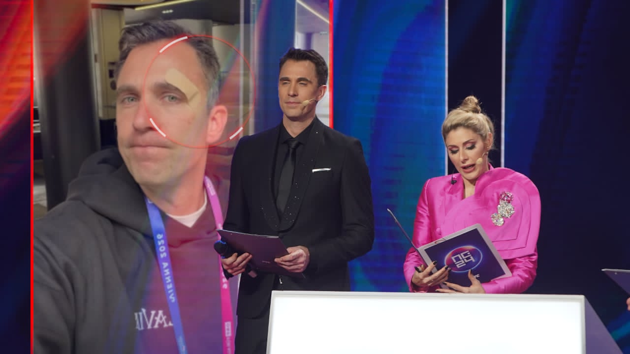 POVREDIO SE VODITELJ RTS-a: Oglasio se sa Evrovizije - "Mnogo je krvarilo"