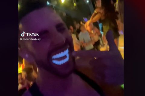 Uradio zube u Turskoj, jer je jeftinije, a onda su se svi SMEJALI: ''Ros, jesi li to ti?'' (VIDEO)
