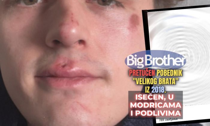 1762015361_pretucen-pobednik-velikog-brata-3.jpg