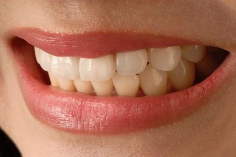 Zaboravite SKUPE lasere i tretmane! Izbelite zube na 5 PRIRODNIH NAČINA