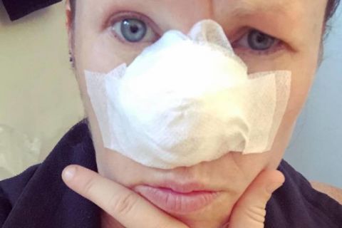 Zbog sitne promene na nosu posetila je plastičnog hirurga, a onda je krenula borba za život (FOTO)